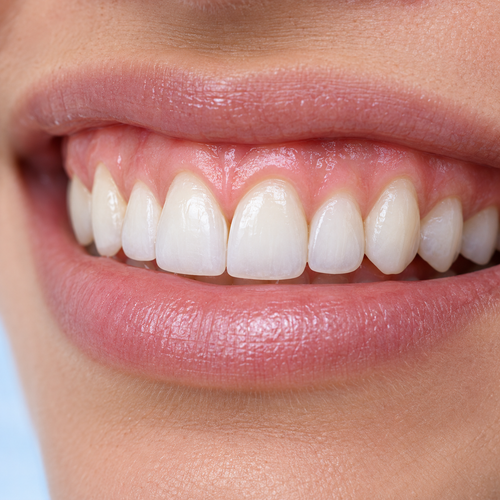 Imagen ilustrativa: Alargamiento coronario por pieza — Clarity Dental